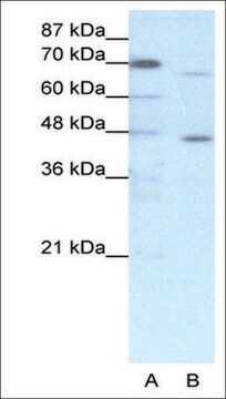 抗ESR2抗体 ウサギ宿主抗体 affinity isolated antibody