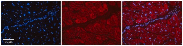 抗PARP16抗体 ウサギ宿主抗体 affinity isolated antibody