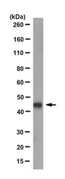 Anticuerpo anti-proteína Gs, subunidad alfa, clon N192/12 clone N192/12, from mouse