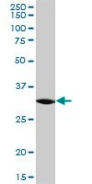 Anti-C21ORF59 antibody produced in mouse purified immunoglobulin, buffered aqueous solution