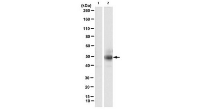 Przeciwciało anty-fosfo-cytokeratyna-18 (K18) (Ser33), klon IB4 clone IB4, from mouse