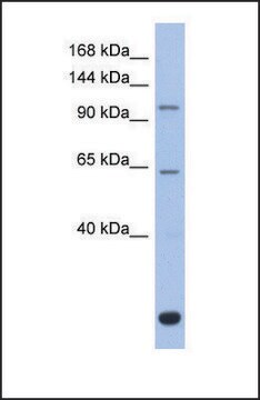 抗BACH2 ウサギ宿主抗体 affinity isolated antibody