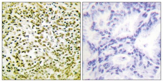 Anti-p53 antibody produced in rabbit affinity isolated antibody