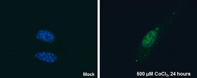 Monoklonalny anty-HIF2alfa clone GT125, affinity isolated antibody