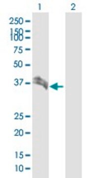 Anti-BST1 antibody produced in rabbit purified immunoglobulin, buffered aqueous solution