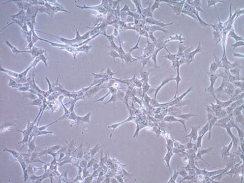 GT1-7 Hypothalamische GnRH-Neuronen-Zelllinie der Maus GT1-7 cells can be used as an in vitro model of GnRH-secreting neurons of the hypothalamus.