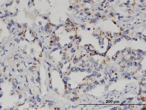 Monoclonal Anti-GSTM2 antibody produced in mouse clone 1E10, purified immunoglobulin, buffered aqueous solution