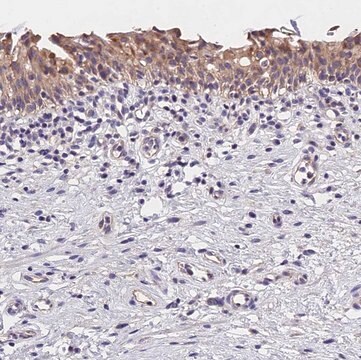 Anti-OAS3 antibody produced in rabbit Prestige Antibodies&#174; Powered by Atlas Antibodies, affinity isolated antibody, buffered aqueous glycerol solution