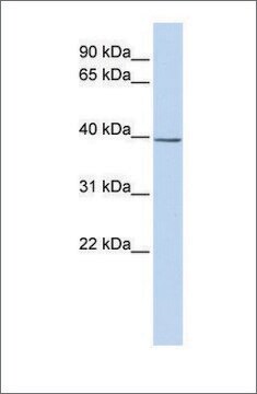 Anti-SETD3 antibody produced in rabbit affinity isolated antibody