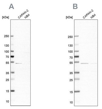 Anti-SPTLC1 antibody produced in rabbit Prestige Antibodies&#174; Powered by Atlas Antibodies, affinity isolated antibody, buffered aqueous glycerol solution