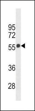 ANTI-CB1 (CENTER) antibody produced in rabbit affinity isolated antibody, buffered aqueous solution