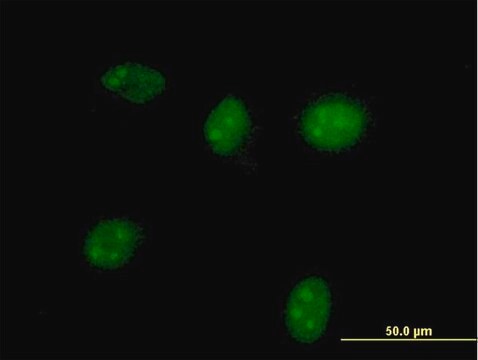 抗HGD抗体 マウス宿主抗体 purified immunoglobulin, buffered aqueous solution