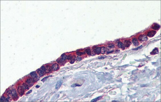 Anti-PLUNC antibody produced in rabbit affinity isolated antibody