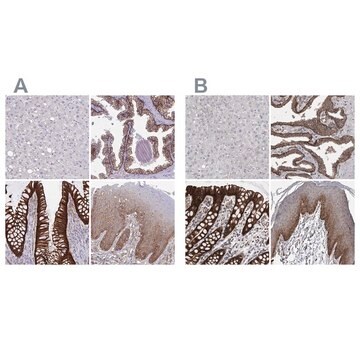 抗LIMA1 ウサギ宿主抗体 Prestige Antibodies&#174; Powered by Atlas Antibodies, affinity isolated antibody, buffered aqueous glycerol solution