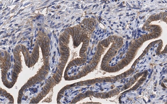 抗PKC&#953;抗体 クローン1J13 ZooMAb&#174;ウサギモノクローナル recombinant, expressed in HEK 293 cells