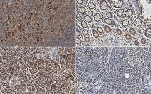 Anti-Cathepsin S from rabbit, purified by affinity chromatography