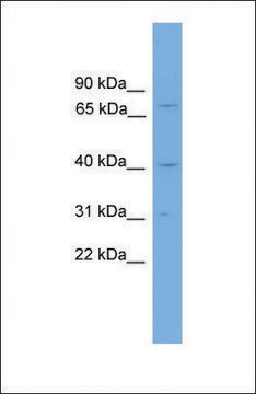 Anti-ATXN3, (N-terminal) antibody produced in rabbit affinity isolated antibody