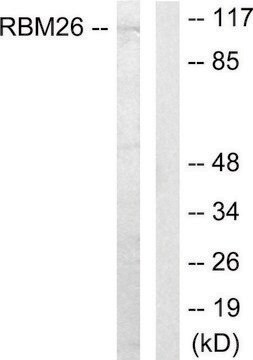 Anti-RBM26 antibody produced in rabbit affinity isolated antibody