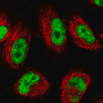 抗-USP22 兔抗 Prestige Antibodies&#174; Powered by Atlas Antibodies, affinity isolated antibody, buffered aqueous glycerol solution