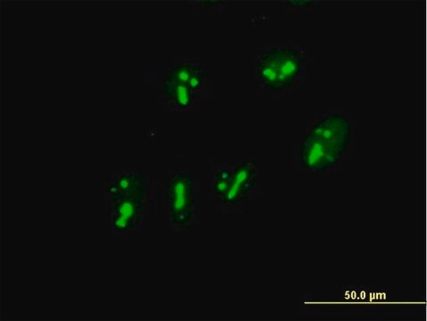 Anti-PARN antibody produced in mouse purified immunoglobulin, buffered aqueous solution