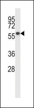 ANTI-PPM1D (CENTER) antibody produced in rabbit affinity isolated antibody, buffered aqueous solution