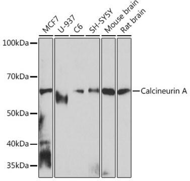 Anti-Calcineurin A Antibody, clone 5I6H8, Rabbit Monoclonal