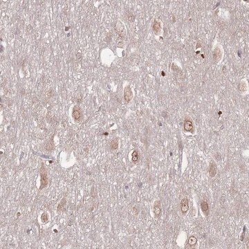 Anti-TBC1D25 antibody produced in rabbit Prestige Antibodies&#174; Powered by Atlas Antibodies, affinity isolated antibody, buffered aqueous glycerol solution