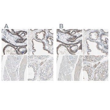 抗B4GALT1 ウサギ宿主抗体 Ab2, Prestige Antibodies&#174; Powered by Atlas Antibodies, affinity isolated antibody, buffered aqueous glycerol solution