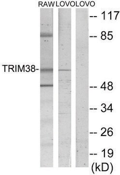 Anti-TRIM38 antibody produced in rabbit affinity isolated antibody