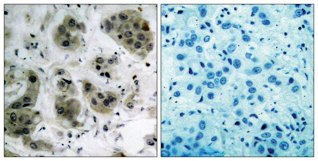 Anti-AKT antibody produced in rabbit affinity isolated antibody