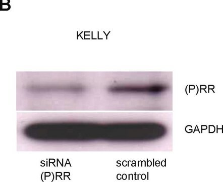 Anti-ATP6AP2 antibody produced in rabbit affinity isolated antibody, buffered aqueous glycerol solution