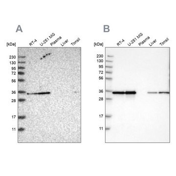 Anti-PPA1 antibody produced in rabbit Prestige Antibodies&#174; Powered by Atlas Antibodies, affinity isolated antibody, buffered aqueous glycerol solution, Ab2