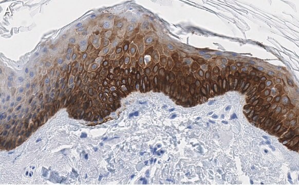 抗サイトケラチン14抗体 クローン1D15 ZooMAb&#174;ウサギ・モノクローナル recombinant, expressed in HEK 293 cells