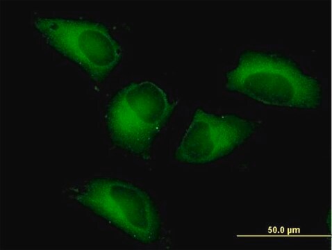 Anti-PFKP antibody produced in mouse IgG fraction of antiserum, buffered aqueous solution