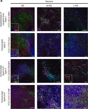 Anti-Reelin Antibody, a.a. 164-496 mreelin, clone G10 clone G10, Chemicon&#174;, from mouse