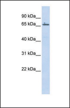 Anti-ZNF503 antibody produced in rabbit affinity isolated antibody