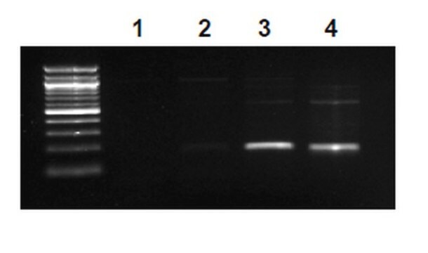 EZ-Magna ChIP&#174; A - Chromatin-Immunpräzipitations-Kit Single day chromatin immunoprecipitation (ChIP) kit containing all necessary reagents to perform 22 individual chromatin immunoprecipitation (ChIP) reactions using magnetic A beads. Control primers included.