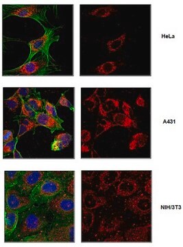 Anti-ATPIF1 Antibody from rabbit, purified by affinity chromatography