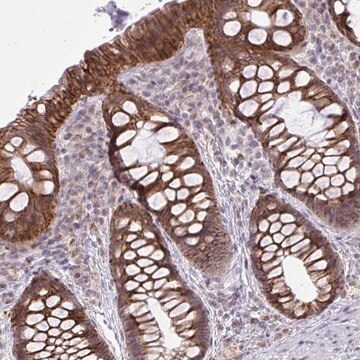 Anti-CYP20A1 antibody produced in rabbit Prestige Antibodies&#174; Powered by Atlas Antibodies, affinity isolated antibody, buffered aqueous glycerol solution