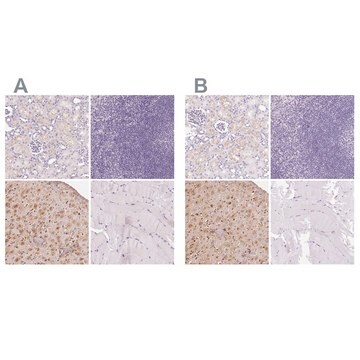 Anti-IGFBP1 antibody produced in rabbit Prestige Antibodies&#174; Powered by Atlas Antibodies, affinity isolated antibody, buffered aqueous glycerol solution