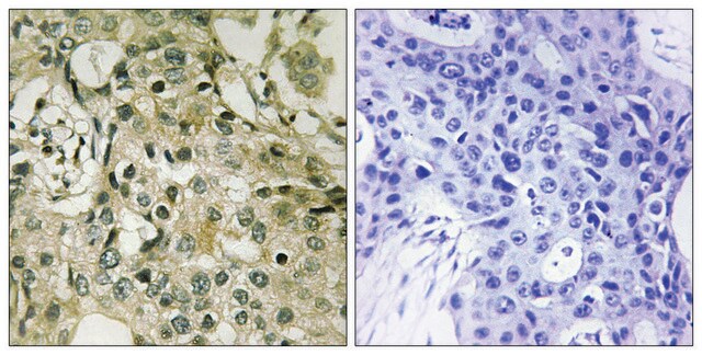 Anti-DTYMK antibody produced in rabbit affinity isolated antibody