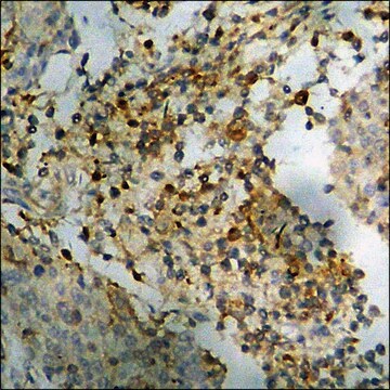 Anti-phospho-Lyn (pTyr507) antibody produced in rabbit affinity isolated antibody