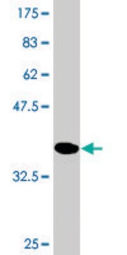 Monoclonal Anti-PYGM, (C-terminal) antibody produced in mouse clone 3D8, purified immunoglobulin, buffered aqueous solution