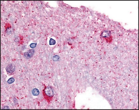 Anti-PYGB (AB2) antibody produced in rabbit affinity isolated antibody, buffered aqueous solution