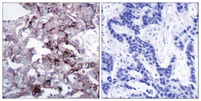 Anti-EGFR antibody produced in rabbit affinity isolated antibody