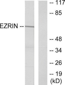 Anti-Ezrin antibody produced in rabbit affinity isolated antibody