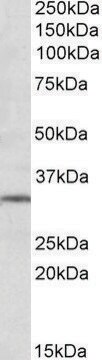 Anti-GRM2 antibody produced in goat affinity isolated antibody, buffered aqueous solution