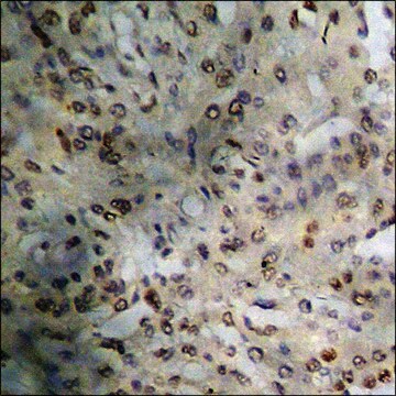 Anti-phospho-FOXO1A (pSer329) antibody produced in rabbit affinity isolated antibody