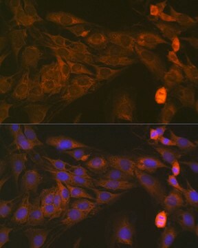 Anti-STAT4 Antibody, clone 10H10O9, Rabbit Monoclonal