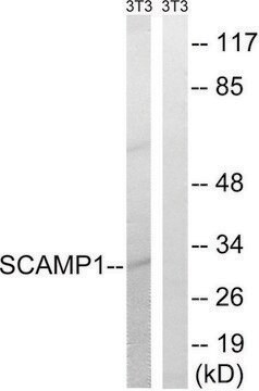 Anti-SCAMP1 antibody produced in rabbit affinity isolated antibody